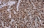 OCT4 Antibody in Immunohistochemistry (Paraffin) (IHC (P))