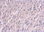 LIN28A Antibody in Immunohistochemistry (Paraffin) (IHC (P))