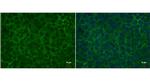 LIN28A Antibody in Immunocytochemistry (ICC/IF)