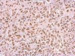 SAMHD1 Antibody in Immunohistochemistry (Paraffin) (IHC (P))