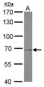 PRMT5 Antibody in Western Blot (WB)