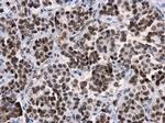 HMGB1 Antibody in Immunohistochemistry (Paraffin) (IHC (P))