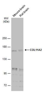 COL11A2 Antibody in Western Blot (WB)