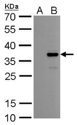 COL11A2 Antibody in Western Blot (WB)