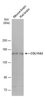 COL11A2 Antibody in Western Blot (WB)