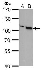 VAV1 Antibody in Western Blot (WB)