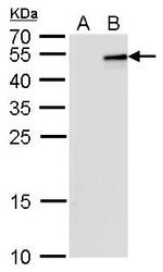 IL-28B Antibody in Western Blot (WB)