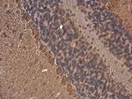 FASN Antibody in Immunohistochemistry (Paraffin) (IHC (P))