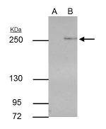 TET2 Antibody in Immunoprecipitation (IP)