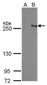 TET2 Antibody in Western Blot (WB)