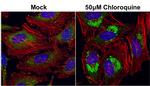 SQSTM1 Antibody in Immunocytochemistry (ICC/IF)