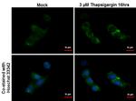 SQSTM1 Antibody in Immunocytochemistry (ICC/IF)