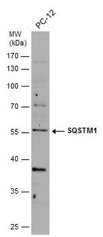 SQSTM1 Antibody in Western Blot (WB)