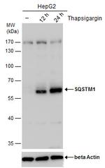 SQSTM1 Antibody in Western Blot (WB)