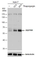 SQSTM1 Antibody in Western Blot (WB)