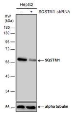 SQSTM1 Antibody in Western Blot (WB)