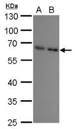 SQSTM1 Antibody in Western Blot (WB)