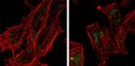 SQSTM1 Antibody in Immunocytochemistry (ICC/IF)