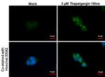 SQSTM1 Antibody in Immunocytochemistry (ICC/IF)