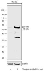 SQSTM1 Antibody