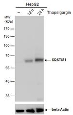 SQSTM1 Antibody in Western Blot (WB)