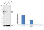 SQSTM1 Antibody in Western Blot (WB)