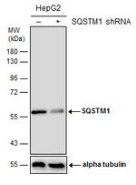 SQSTM1 Antibody in Western Blot (WB)