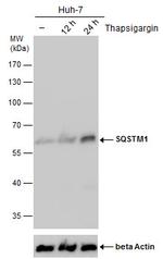 SQSTM1 Antibody in Western Blot (WB)