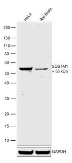 SQSTM1 Antibody in Western Blot (WB)