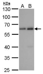 SQSTM1 Antibody in Western Blot (WB)