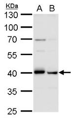 TDP-43 Antibody in Western Blot (WB)