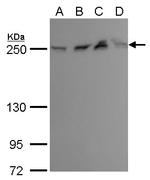 mTOR Antibody in Western Blot (WB)