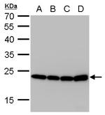 SOD2 Antibody in Western Blot (WB)