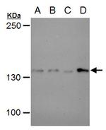 USP7 Antibody in Western Blot (WB)