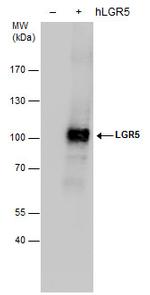 LGR5 Antibody in Western Blot (WB)