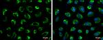 Glutaminase C (GAC) Antibody in Immunocytochemistry (ICC/IF)