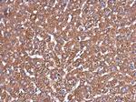 Glutaminase C (GAC) Antibody in Immunohistochemistry (Paraffin) (IHC (P))