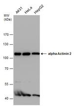 alpha Actinin 2 Antibody in Western Blot (WB)