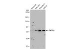 ACSL4 Antibody in Western Blot (WB)