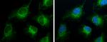 ACSL4 Antibody in Immunocytochemistry (ICC/IF)