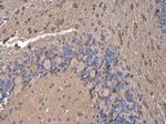 ACSL4 Antibody in Immunohistochemistry (Paraffin) (IHC (P))