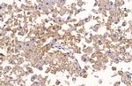 Glypican 3 Antibody in Immunohistochemistry (Paraffin) (IHC (P))