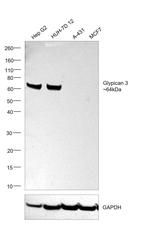 Glypican 3 Antibody in Western Blot (WB)