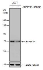 ATP6V1A Antibody in Western Blot (WB)