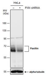 Paxillin Antibody in Western Blot (WB)