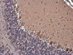 Phospho-p130Cas (Tyr249) Antibody in Immunohistochemistry (Paraffin) (IHC (P))