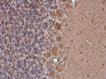 Phospho-p130Cas (Tyr249) Antibody in Immunohistochemistry (Paraffin) (IHC (P))