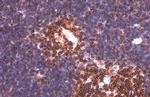 PYK2 Antibody in Immunohistochemistry (Paraffin) (IHC (P))