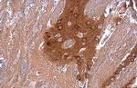 PYK2 Antibody in Immunohistochemistry (Paraffin) (IHC (P))