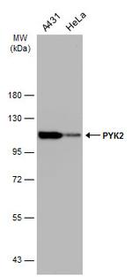 PYK2 Antibody in Western Blot (WB)